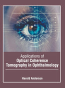 Applications of Optical Coherence Tomography in Ophthalmology-9781639870530