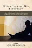 Beaten Black and Blue : Born into Racism-9781665580229