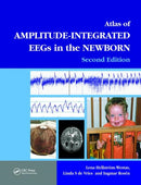 An Atlas of Amplitude-Integrated EEGs in the Newborn-9781841846491