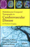 Multidetector Computed Tomography in Cerebrovascular Disease