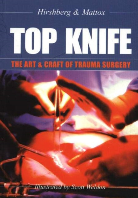 Top Knife