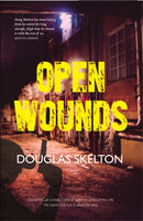 Open Wounds-9781910745335