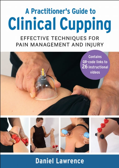 A Practitioner's Guide to Clinical Cupping : Effective Techniques for Pain Management and Injury-9781913088330