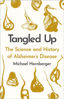 Tangled Up : The History and Science of Alzheimer's Disease Volume 3-9781914487422