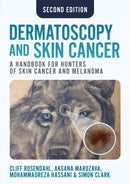 Dermatoscopy and Skin Cancer, second edition : A handbook for hunters of skin cancer and melanoma-9781914961670