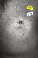 Supplement 3: The Invention and Conclusion of the Eye-9781927354346