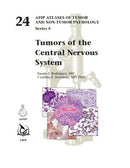 Tumors of the Central Nervous System-9781933477640