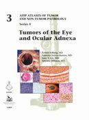 Tumors of the Eye and Ocular Adnexa-9781933477923