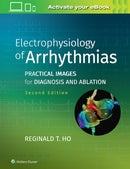 Electrophysiology of Arrhythmias : Practical Images for Diagnosis and Ablation-9781975101107