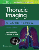 Thoracic Imaging: A Core Review-9781975126223