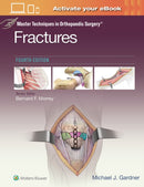 Master Techniques in Orthopaedic Surgery: Fractures-9781975139407