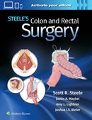 Steele's Colon and Rectal Surgery-9781975152895