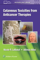 Cutaneous Toxicities from Anticancer Therapies-9781975157890