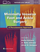 Minimally Invasive Foot and Ankle Surgery : A Percutaneous Approach-9781975198701