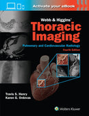 Webb & Higgins Thoracic Imaging: Print + eBook with Multimedia-9781975199388