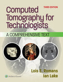 Computed Tomography for Technologists : A Comprehensive Text-9781975232931