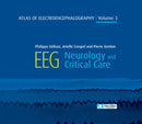 Atlas of Electroencephalography Volume 3 : EEG Neurology and Critical Care-9782742015795