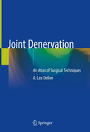 Joint Denervation : An Atlas of Surgical Techniques-9783030055370