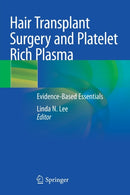 Hair Transplant Surgery and Platelet Rich Plasma : Evidence-Based Essentials-9783030546502