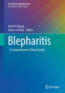 Blepharitis : A Comprehensive Clinical Guide-9783030650421