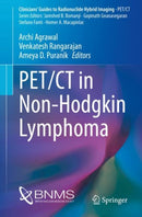 PET/CT in Non-Hodgkin Lymphoma-9783030790066