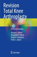 Revision Total Knee Arthroplasty : A Practical Guide-9783030812874