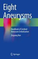 Eight Aneurysms : Handbook of Cerebral Aneurysm Embolization-9783030972189