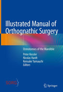 Illustrated Manual of Orthognathic Surgery : Osteotomies of the Mandible-9783031069772