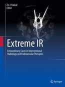 Extreme IR : Extraordinary Cases in Interventional Radiology and Endovascular Therapies-9783031242502