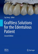 Graftless Solutions for the Edentulous Patient-9783031328466