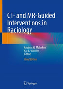 CT- and MR-Guided Interventions in Radiology-9783031969010