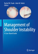 Management of Shoulder Instability