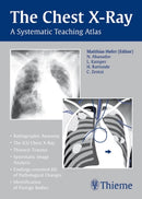 The Chest X-Ray : A Systematic Teaching Atlas-9783131442116