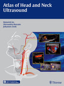 Atlas of Head and Neck Ultrasound-9783131603517