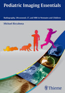 Pediatric Imaging Essentials : Radiography, Ultrasound, CT and MRI in Neonates and Children-9783131661913
