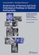 Freyschmidt's "Koehler/Zimmer" Borderlands of Normal and Early Pathological Findings in Skeletal Radiography-9783137841050