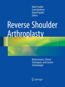 Reverse Shoulder Arthroplasty : Biomechanics, Clinical Techniques, and Current Technologies-9783319371535