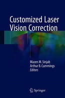 Customized Laser Vision Correction-9783319722627