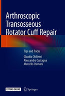 Arthroscopic Transosseous Rotator Cuff Repair