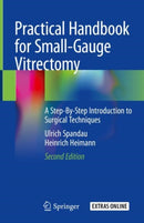Practical Handbook for Small-Gauge Vitrectomy : A Step-By-Step Introduction to Surgical Techniques-9783319896762