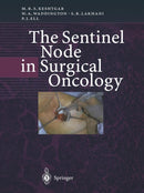 The Sentinel Node in Surgical Oncology-9783642642302