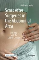 Scars After Surgeries in the Abdominal Area : Self-Help with the Liedler-Concept-9783662713761