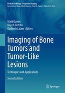 Imaging of Bone Tumors and Tumor-Like Lesions