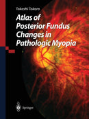 Atlas of Posterior Fundus Changes in Pathologic Myopia-9784431680185