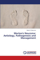 Morton's Neuroma : Aetiology, Pathogenesis and Management-9786139838691