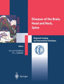 Diseases of the Brain, Head and Neck, Spine : Diagnostic Imaging and Interventional Techniques-9788847002517