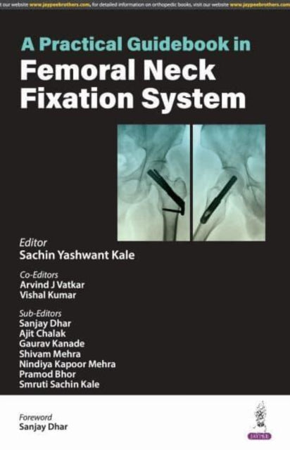 A Practical Guidebook in Femoral Neck Fixation System-9789356965959