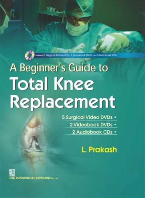 A Beginner's Guide to Total Knee Replacement-9789386217486
