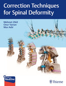 Correction Techniques for Spinal Deformity-9789395390101