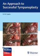 An Approach to Successful Tympanoplasty-9789395390934